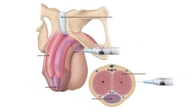 Injected to increase potency